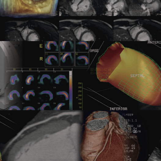 Máster Universitario de Diagnóstico por la imagen en cardiología
