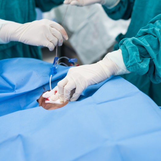 Máster en Intervencionismo Endovascular Estructural 2025-2027